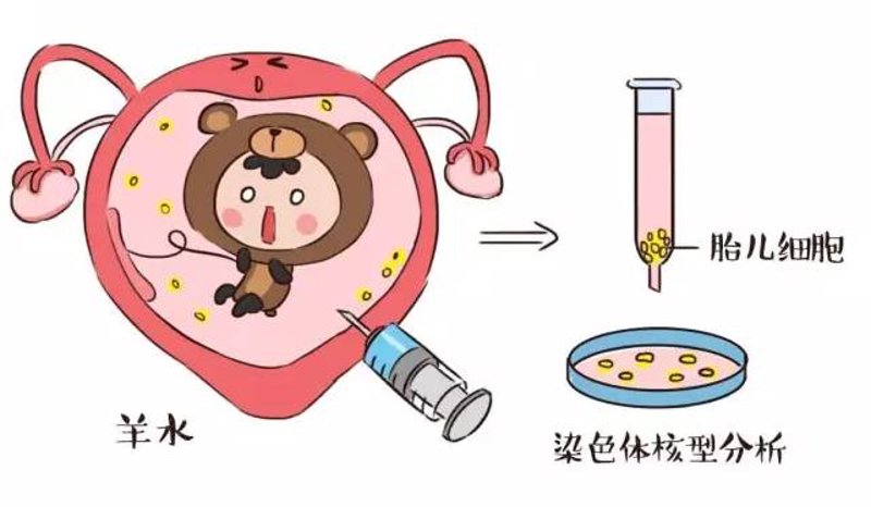 唐氏筛查